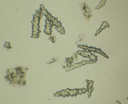 File:Spicules.jpg