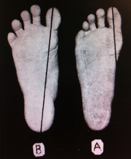 File:Adult foot that has never worn shoes.jpg