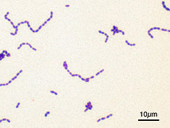 Streptococcus mutans Gram.jpg