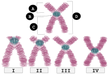 Jenis-Jenis kromosom, gambar I = kromosom telosentrik, gambar II = akrosentrik, gambar III = submetasentrik, gambar IV = metasentrik