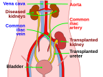 Thumbnail for Kidney transplantation