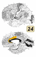 ブロードマンの脳地図における24野。