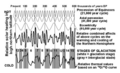 Milankovitch cycles.