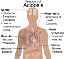 General symptoms of acidosis,[9]