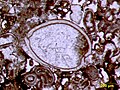 Image 21Articulated ostracod valves in cross-section from the Permian of central Texas; typical thin section view of an ostracod fossil (from Ostracod)