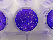 Plaque assay for herpes simplex virus