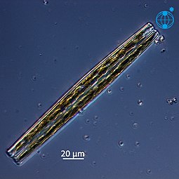 Stand-alone cell of Bacillaria paxillifer