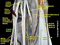 Đám rối cánh tay. Thần kinh trụ (Ulnar nerve) có màu xanh lá cây.