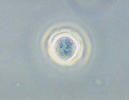 Acanthamoeba polyphaga a ciszta állapotában