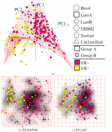 Elmap breastcancer wiki.png