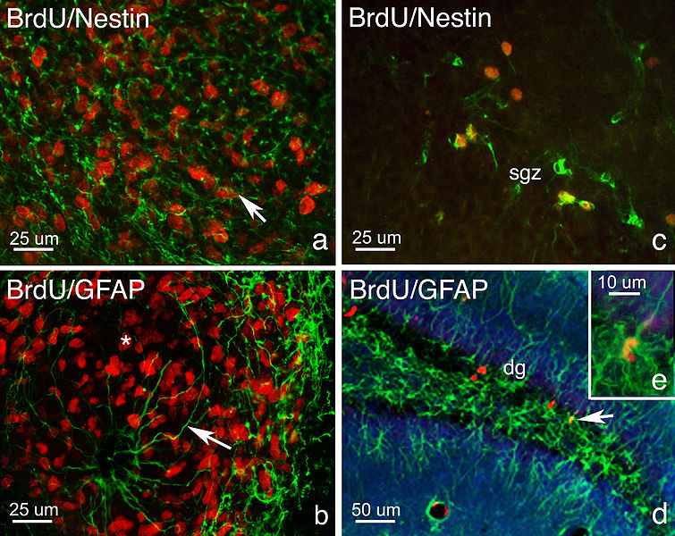 File:Phenotypes of proliferating cells in the Rostral Migratory Stream and Dentate Gyrus.jpg