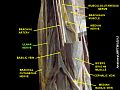 Thần kinh trụ (Ulnar nerve)