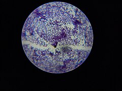 Gram positive Bacteria.jpg