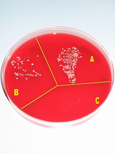 File:Hand desinfection test with blood agar plate.jpg