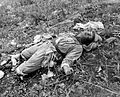Chinese casualty in the Korean War