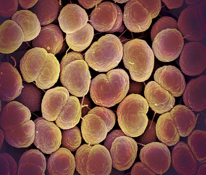 File:Neisseria gonorrhoeae Bacteria - 53136604826.jpg