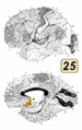 ブロードマンの脳地図における25野。
