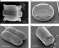 February 18: Frustules of several diatoms.
