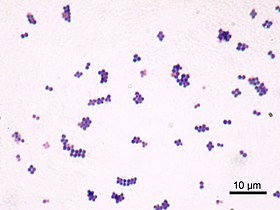 Staphylococcus aureus com técnica Gram