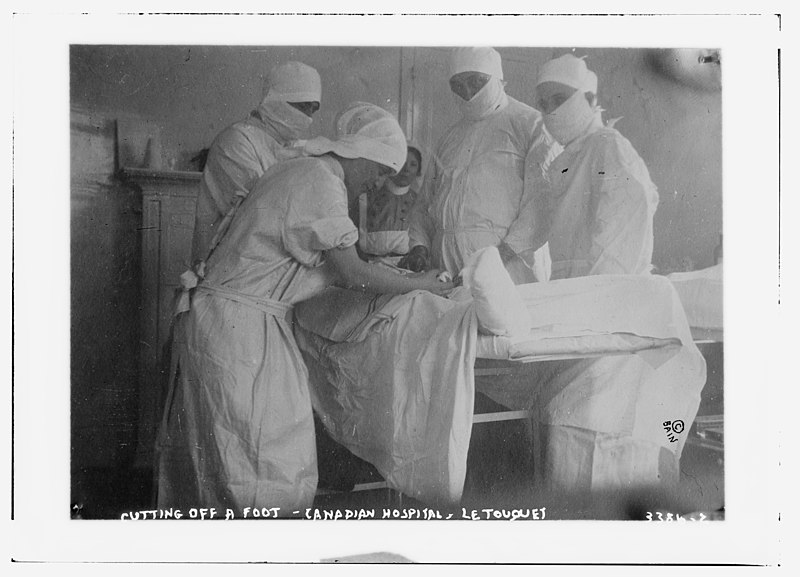 File:Cutting off a foot - Canadian Hospital, Le Touquet LCCN2014698489.jpg