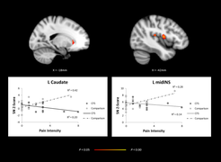 CFS-brain-activity-salientnetwork.png