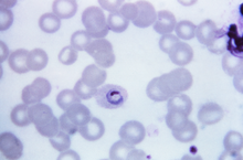 Plasmodium ovale 01.png