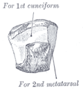 Anteromedial vy