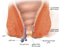 رسم تخطيطي توضيحي لتشريح البواسير.