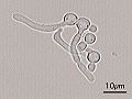 Germ tubes of Candida albicans