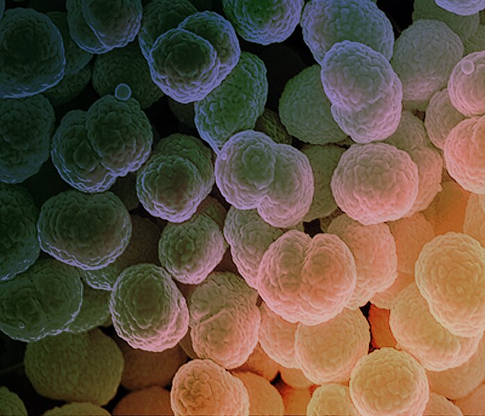 File:Neisseria gonorrhoeae Bacteria - 53136805124.jpg