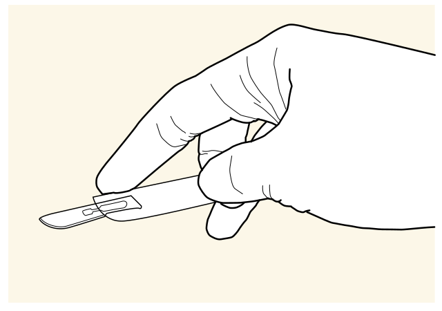 File:ScalpelGrip Palmar-Plain.svg