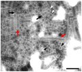 particles in an abalone shriveling syndrome-associated virus suspension