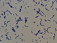 Viridans strptococci in Gram stain.jpg