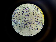 Gram positive Bacteria 2.jpg