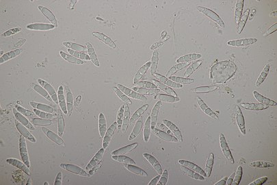 Leotia lubrica, ascospores multiguttulées