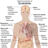 Most common symptoms of any kind of snake bite poisoning.[3] The respiratory effects are most serious, requiring immediate contact with health provider.[3]