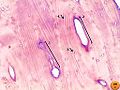 Bone by decalcification (100x): Volkmann's canal Haversian canal Lacunae Lamellae