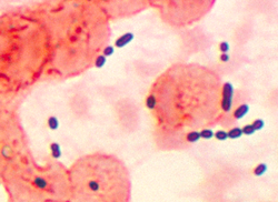 Enterococcus keuhkokudoksessa