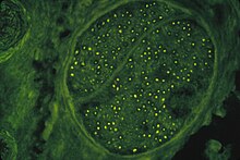 HIV-induced autoimmun-antiMyelin Antibodies against human nerve tissue (FITC-Stain)