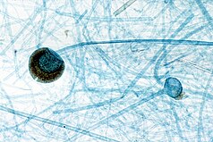 Sporangioj de Rhizopus sp. kun sporangio kaj kolumelo