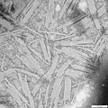 An electron micrograph kantobacco mosaic virus