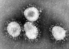 Electron micrograph of SARS coronaviruses