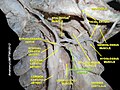 Stylopharyngeus muscle