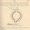 The 1898 Krebs double-acting brake on the differential axle.