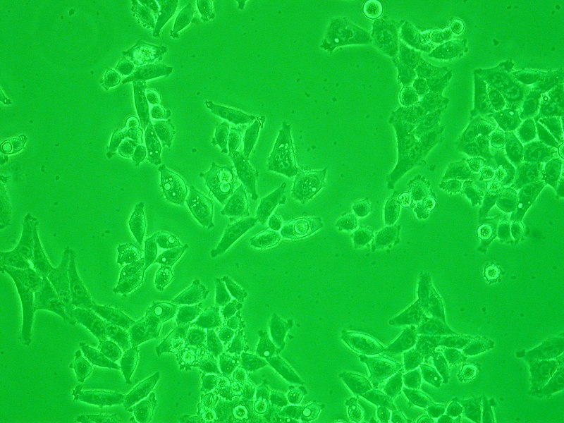 File:HeLa cells.jpg