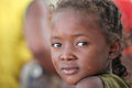 Image 1A Malagasy child (from Madagascar)