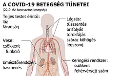 A SARS-CoV-2 koronavírus-fertőzésének behatolási kapuja a felső légúti nyálkahártya