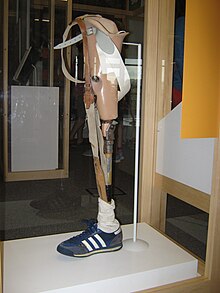 a prosthetic leg in a display case