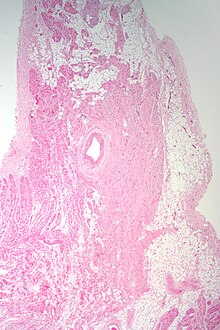 Sinoatrial node low mag.jpg