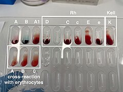 Blood Types.jpg